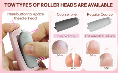 SoleGlow™ – Electronic Cordless Pedicure & Callus Deadskin Remover ✨🦶