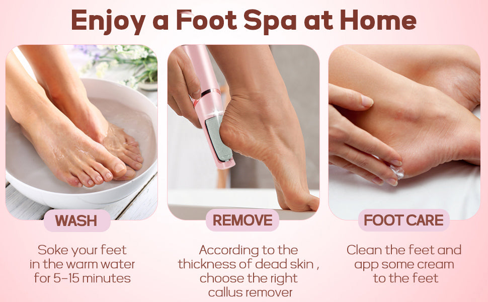 SoleGlow™ – Electronic Cordless Pedicure & Callus Deadskin Remover ✨🦶